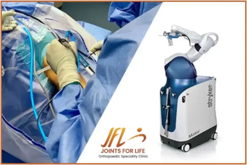 Robotic Knee Replacement Current Evidence Based Status | Joints for Life