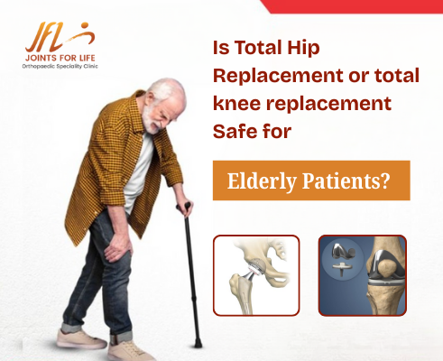 Total Hip Replacement or Total Knee Replacement